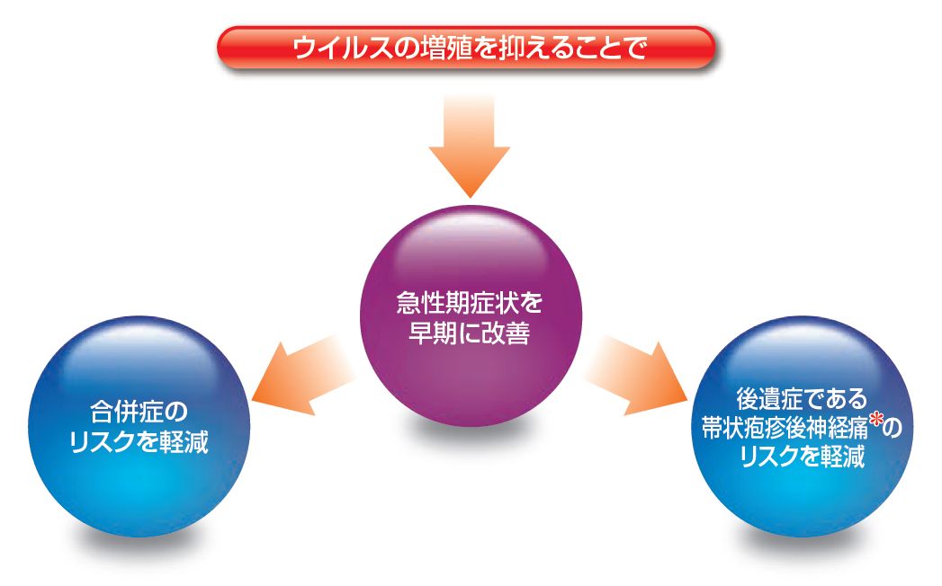 帯状疱疹の治療のイメージイラスト